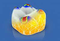 CEREC AC OMNICAM ПРОСТОЕ СКАНИРОВАНИЕ БЕЗ АНТИБЛИКОВОГО СПРЕЯ 14.jpg CEREC AC OMNICAM ПРОСТОЕ СКАНИРОВАНИЕ БЕЗ АНТИБЛИКОВОГО СПРЕЯ 14.jpg